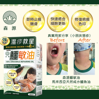 森源 鱷敏油+鱷敏膏 兩件套裝 香港製造