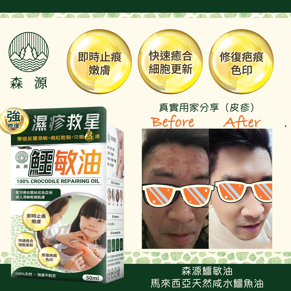 森源 鱷敏油+鱷敏膏 兩件套裝 香港製造