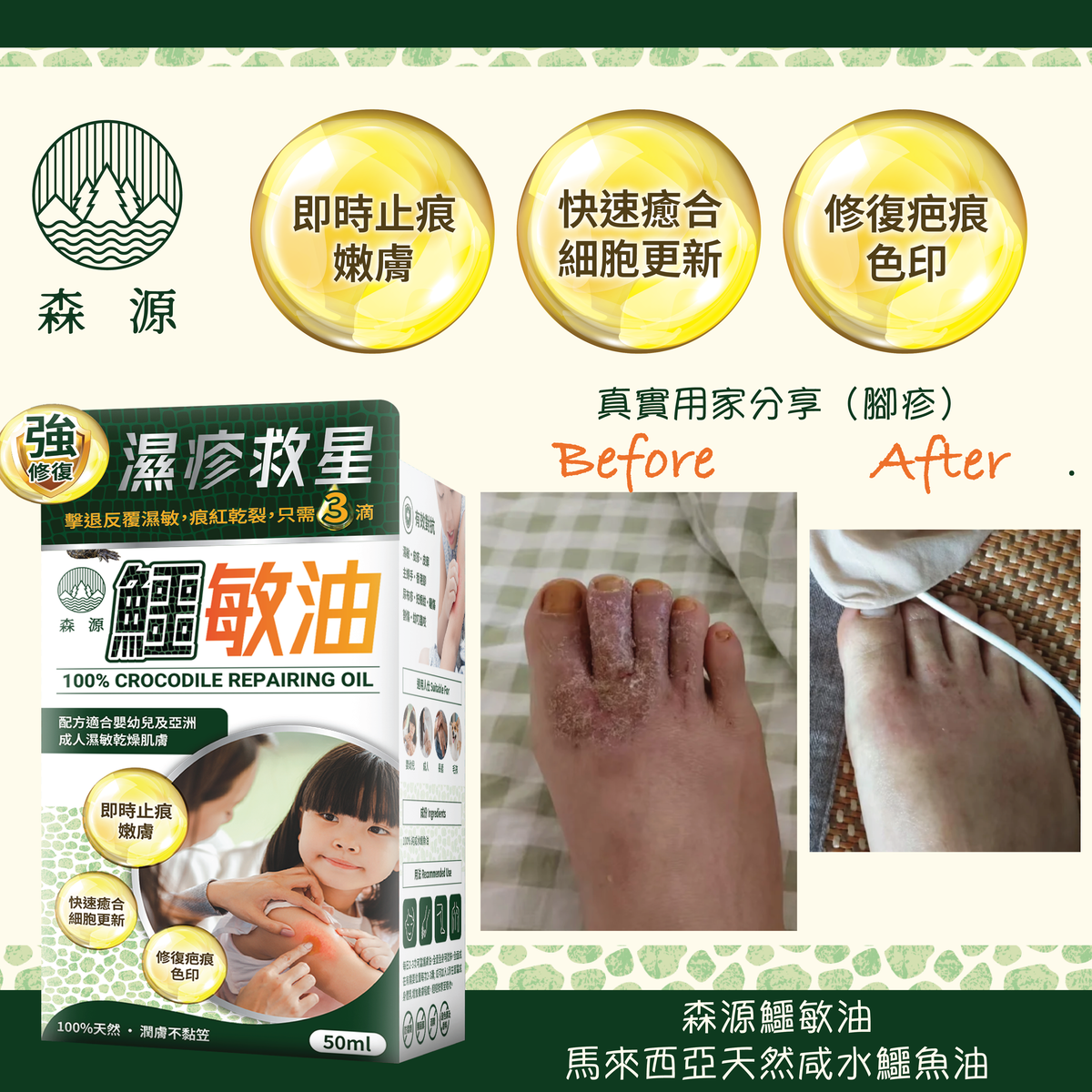 森源 鱷敏油+鱷敏膏 兩件套裝 香港製造