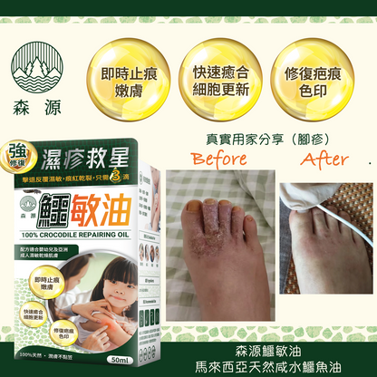 森源 鱷敏油+鱷敏膏 兩件套裝 香港製造