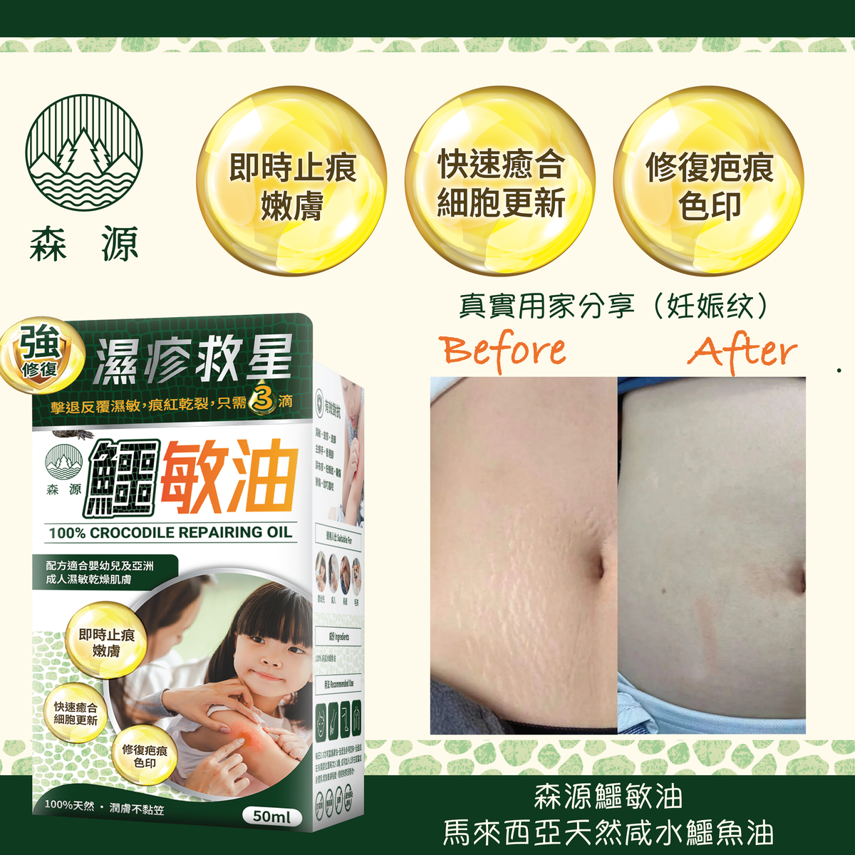 森源 鱷敏油 濕疹 敏感肌膚 疤痕 暗瘡 咸水鱷 適合嬰幼兒 鱷魚油 鱷膚油 香港制造