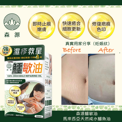 森源 鱷敏油+鱷敏膏 兩件套裝 香港製造