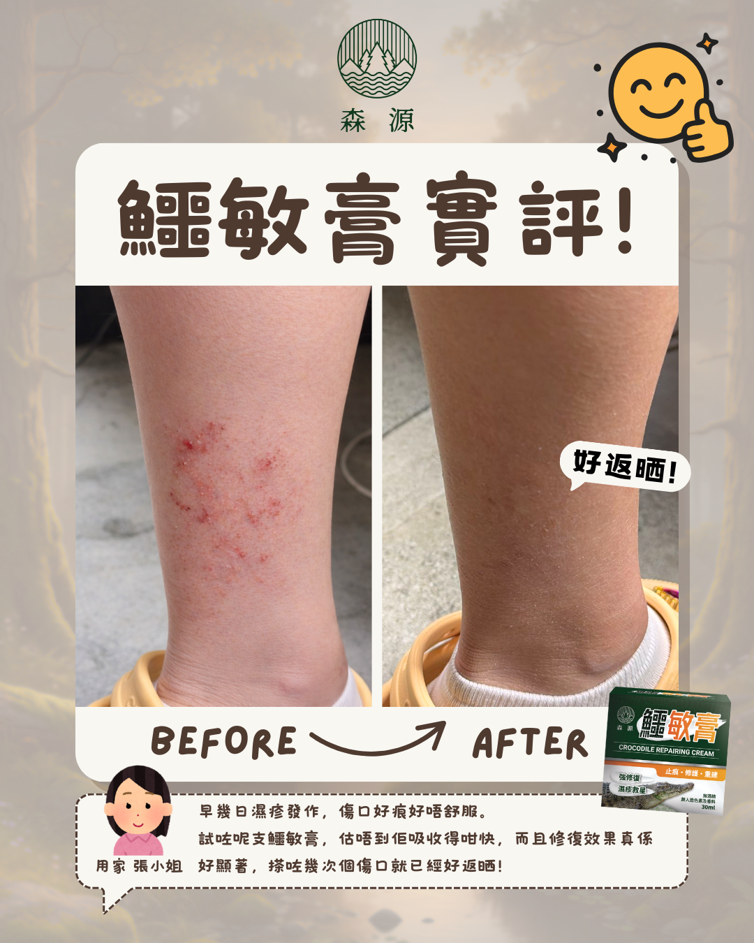森源 鱷敏膏