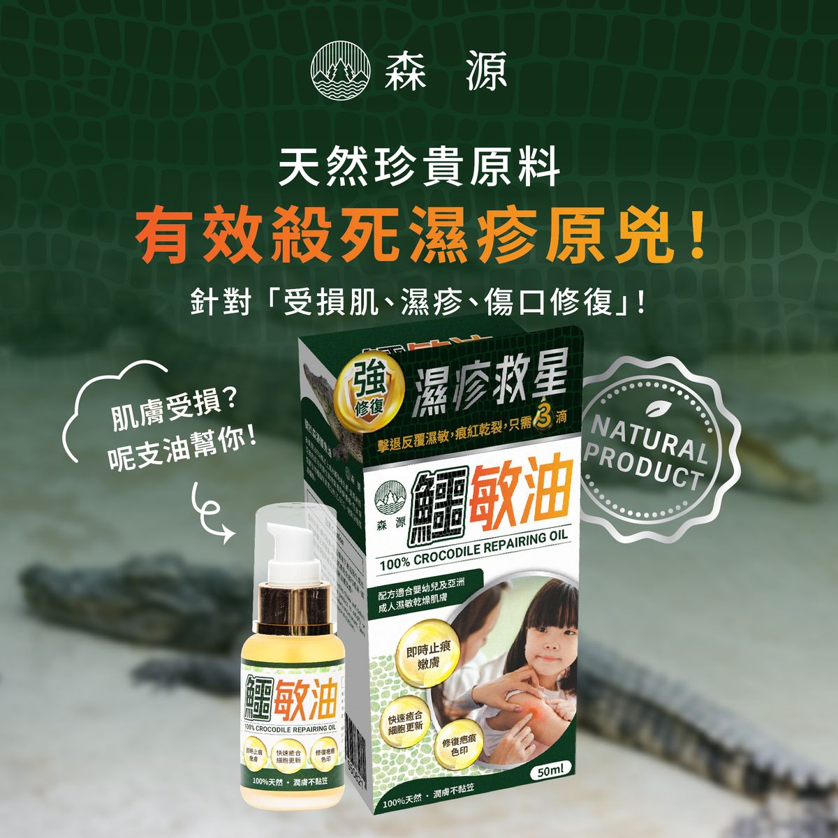 森源 鱷敏油 濕疹 敏感肌膚 疤痕 暗瘡 咸水鱷 適合嬰幼兒 鱷魚油 鱷膚油 香港制造